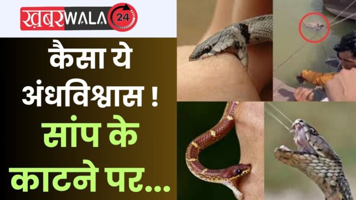 Snake Bite Viral Video